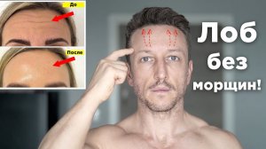 Как УБРАТЬ МОРЩИНЫ на ЛБУ без БОТЕКСА массаж 3 минуты