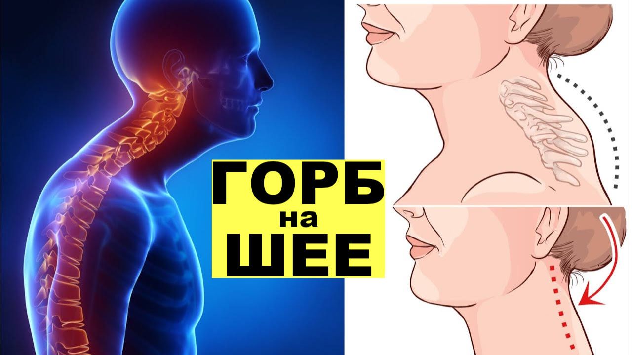Ка исправить горб на шее и сделать лицо худым. Можно делать сидя или стоя.
