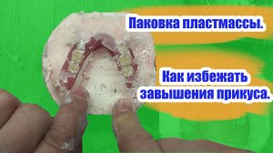 Нижний ЗУБНОЙ ПРОТЕЗ. Паковка пластмассы. Как избежать завышения прикуса