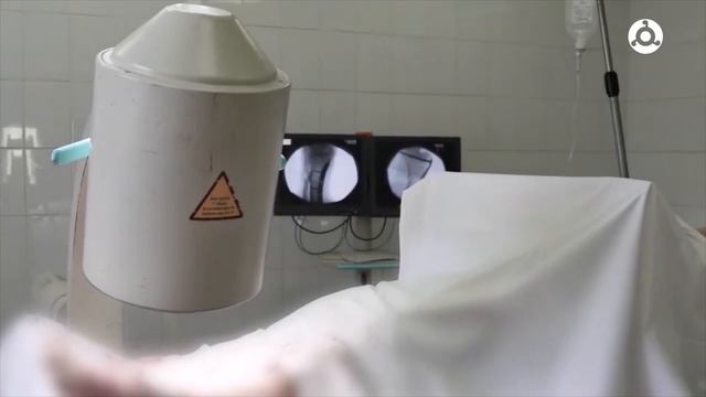 ЗОЖ. Переломы смотреть онлайн