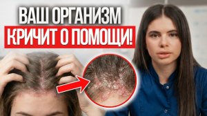 ОПАСНЫЕ причины ШЕЛУШЕНИЯ и покраснения кожи! Лечение себорейного дерматита!