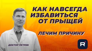 Как избавиться от прыщей