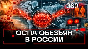 Два новых случая оспы обезьян зафиксировали в России