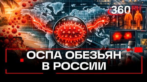 Два новых случая оспы обезьян зафиксировали в России