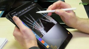 Как врачи помогли самарской пианистке победить врождённую патологию