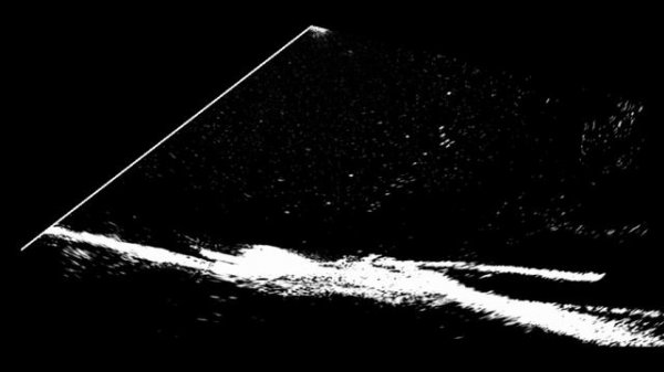 LOWRANCE ACTIVE TARGET На каряге2 ВВ