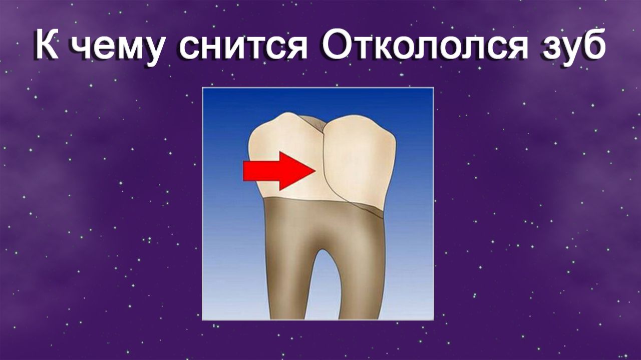 К чему снится Откололся зуб - толкование сна смотреть онлайн