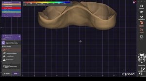 Как сделать индивидуальную ложку в Exocad