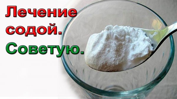 Лечение содой. СОВЕТУЮ