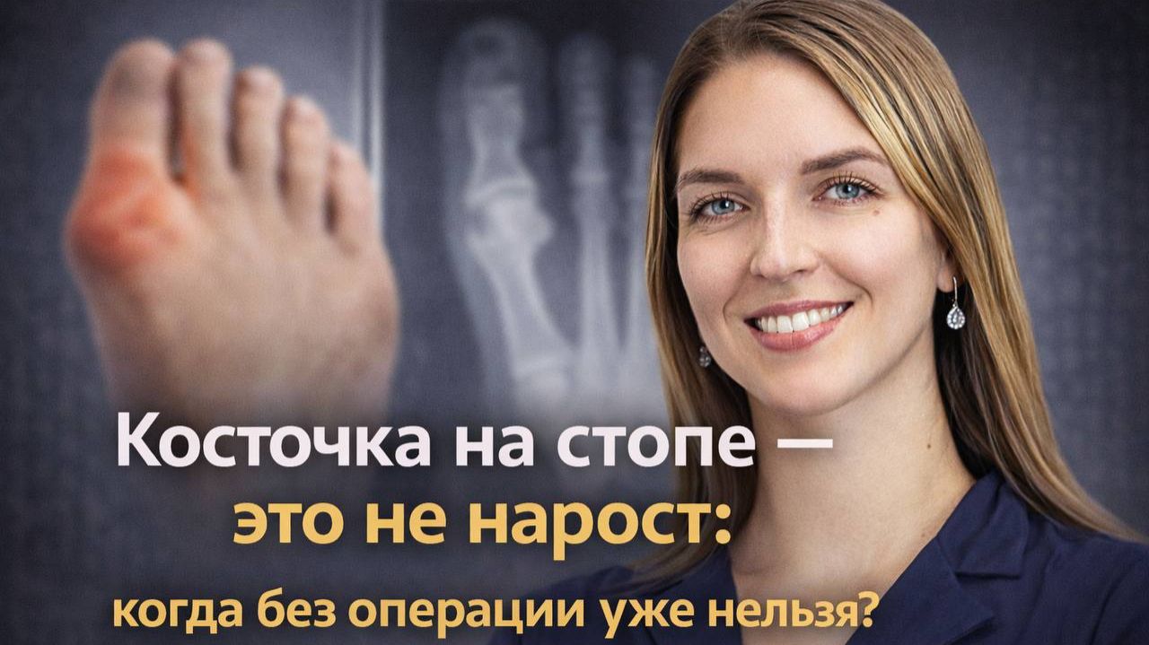Вальгус стопы: почему растёт “косточка” и как её лечат на самом деле смотреть онлайн