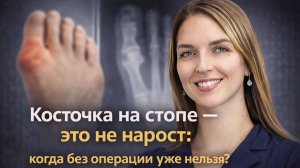 Вальгус стопы: почему растёт “косточка” и как её лечат на самом деле