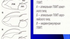 1,2. Кардиомиопатии