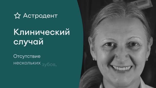 КЕЙС: Восстановление улыбки