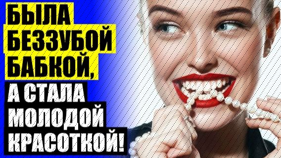 😀 Чем отличается винир от коронки 🔵 Вениры или виниры ✔