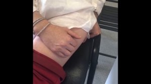 Работа со швами после косметических процедур и операций