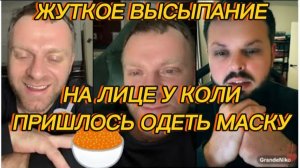 САМВЕЛ АДАМЯН, ЖУТКОЕ ВЫСЫПАНИЕ НА ЛИЦЕ У КОЛИ, ПРИШЛОСЬ ОДЕТЬ МАСКУ..