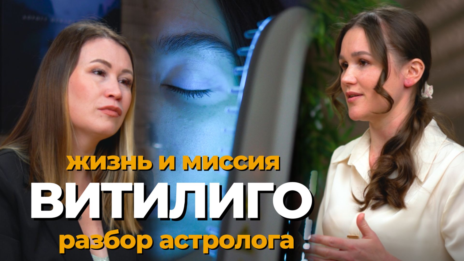 Как витилиго стало делом и миссией жизни. Разбор астролога Ольги Мун