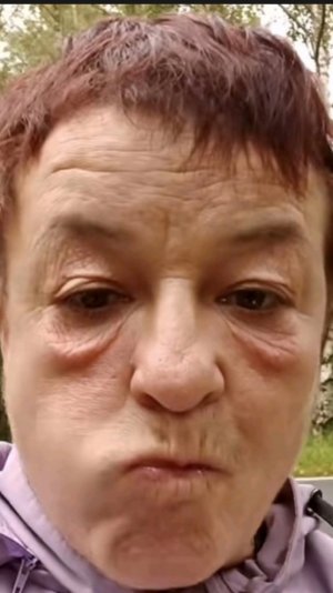 курага пожирает кожу старой свиньи