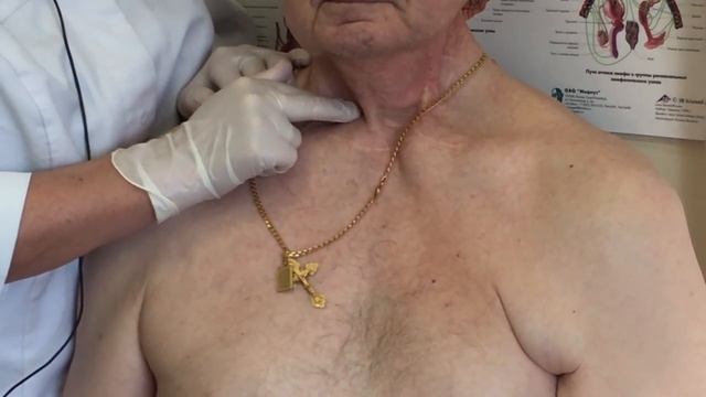 Помощь себе, при работе с послеоперационными шрамами. смотреть онлайн