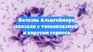 Болезнь Альцгеймера связали с токсоплазмой и вирусом герпеса
