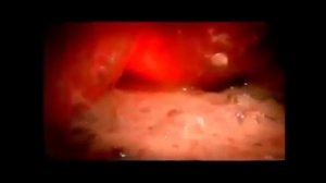 Цветок Венеры