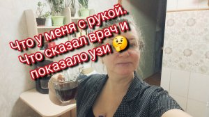 Что у меня с рукой. Что сказал врач и показало узи