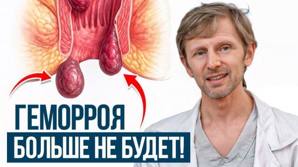 90% людей лечат ГЕМОРРОЙ НЕПРАВИЛЬНО?! / Вот, что нужно делать НА САМОМ ДЕЛЕ!