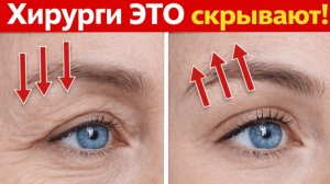 Как подтянуть верхнее веко без операции в любом возрасте?  Делай 5 минут в день