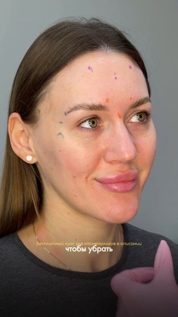 Избавляемся от морщин ботоксом