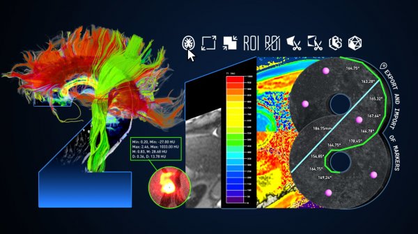 Новые функции в Inobitec DICOM Viewer 2.18