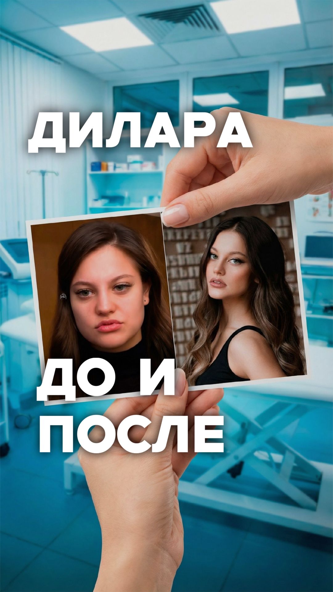 Дилара изменилась до неузнаваемости! Косметолог раскрывает секрет