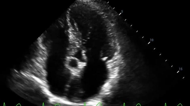 4.2 смотреть онлайн