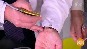 Бородавки, которые стыдно показать. Жить здорово! Фрагмент выпуска от 18.02.2026