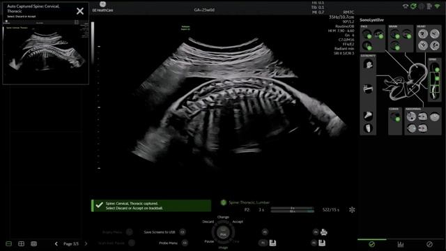 SonoLystLive - не нужно замораживать, комментировать и сохранять. смотреть онлайн