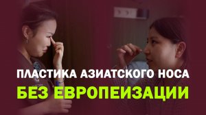 Азиатская ринопластика у Репиной Аси Сергеевны: деликатное изменение без потери индивидуальности