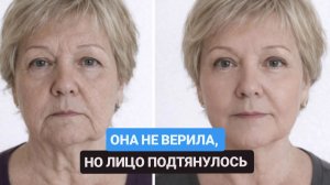 Как подтянуть лицо без операции. Всего 3 упражнения