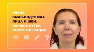 Елена. СМАС-подтяжка лица и шеи. Первые сутки после операции