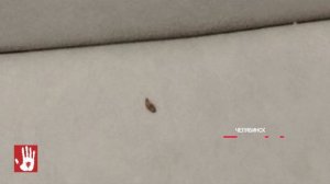 Из гардероба детской горбольницы людям вернули куртку с тараканом в кармане!