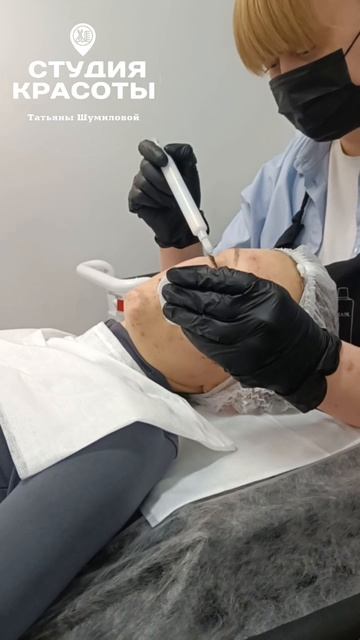 Устали от высыпаний и ищешь щадящий аппаратный метод? Рассказываем про холодную плазму