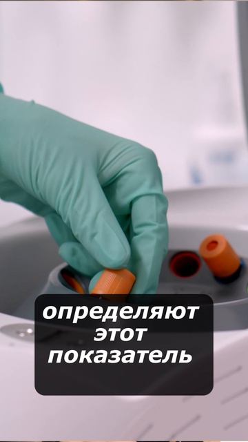 Гематокрит: почему врачи смотрят именно на этот показатель?