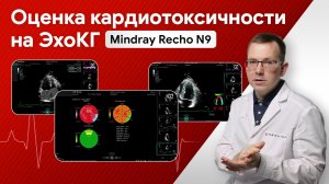 Кардиотоксичность на фоне химиотерапии: как оценить? ЭхоКГ на Mindray Recho N9
