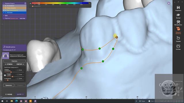 Частично-съемный на верх смотреть онлайн
