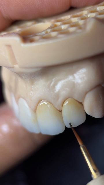 Подпишись и стань ТОП-техником тратя 5 мин в день на моем канале👇 #зубнойтехник #аннаакулова