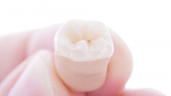 Препарирование OVERLAY | IDS