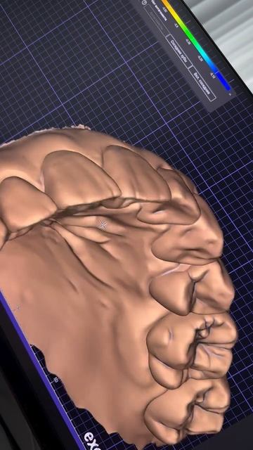Как относитесь к такой выраженной морфологии?)Хорошо или любите поспокойнее?)