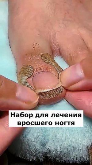 Артикул Я.Маркет 👉 YM10236041 (не забудь при поиске YM)