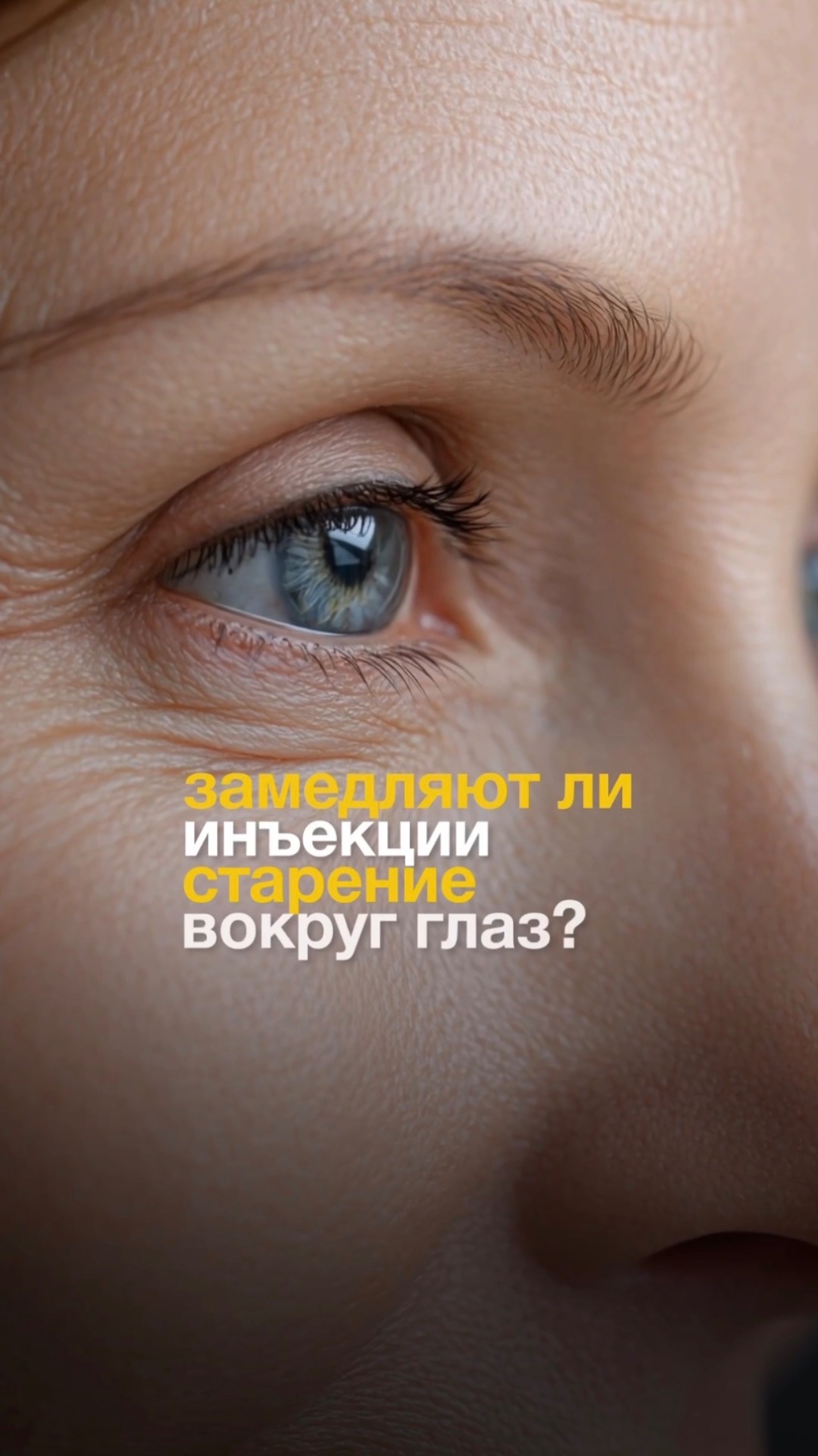 Замедляют ли инъекции старение вокруг глаз? смотреть онлайн