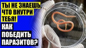 👌 МОЖЕТ ЛИ БОЛЕТЬ ЖИВОТ ОТ ГЛИСТОВ 🔵 СИЛЬНОЕ ЛЕКАРСТВО ОТ ГЛИСТОВ ВЗРОСЛОМУ