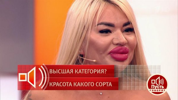 "Самые большие губы страны!" Анастасия Шаляпина рассказала, что тратит 500 тыс. рублей в месяц на...
