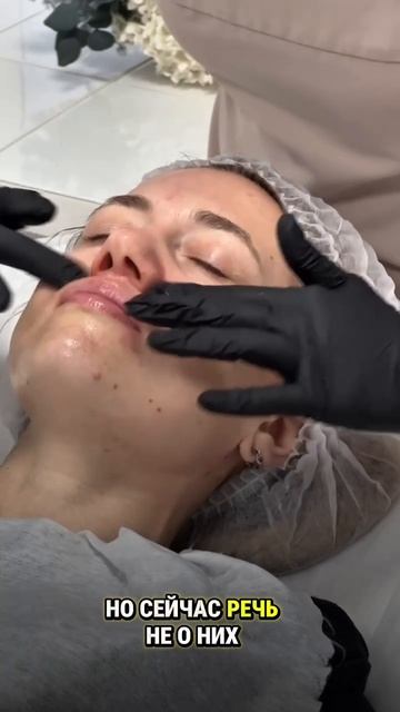 Пилинг смотреть онлайн